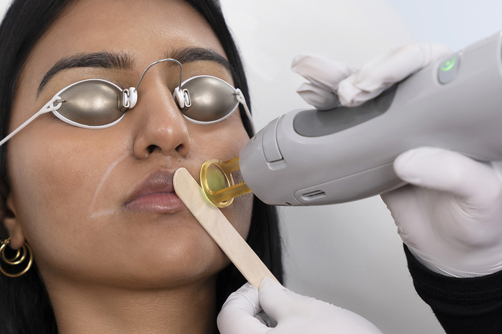 Woman lying back wearing safety protective goggles with medical pro dragging laser hair removal tool across upper lip area